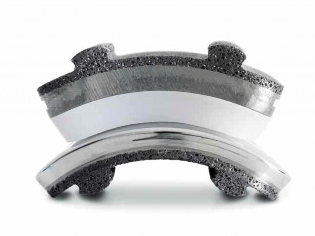 Total Ankle Repair Implant - Wright Medical (Stryker) - INBONE™ Total Ankle System Wright Medical (Stryker) - INFINITY™ Total Ankle System DJO - Scandinavian Total Ankle Replacement (STAR™ Ankle) Exactech - Vantage Total Ankle