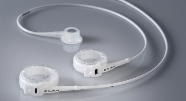 Massive Declines in the U.S. Gastric Band Market as Surgeons Switch to More Cost-Effective Gastric Bypass and Sleeve Gastrectomy Procedures