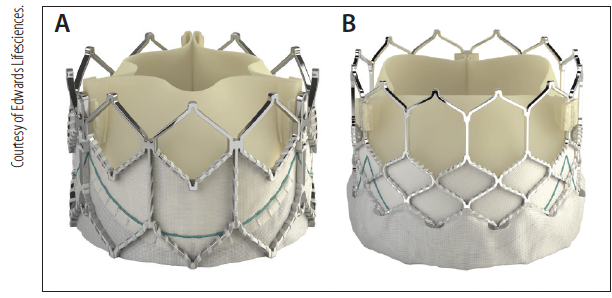 Edwards Lifesciences, Medtronic Lead US Market for Transcatheter Heart Valve Replacement Devices Fueled by Growing Demand for Minimally Invasive Surgeries
