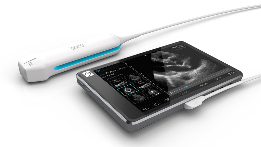 SonoSite Leads US Vascular Access Ultrasound Market Despite Competitive Pricing Pressure from Less Expensive Units