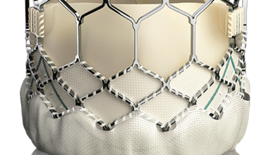 Edwards Wins Latest TAVR Patent Dispute Against Boston Scientific