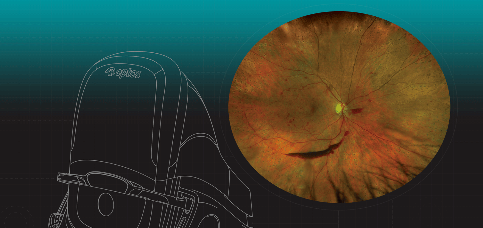 Optos Unveils Monaco, Retinal Imaging Device with OCT