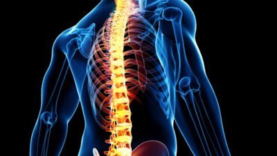Brazil Spinal Implants Market to Reach Over $530 Million by 2024, Led by Zimmer Biomet and DePuy Synthes