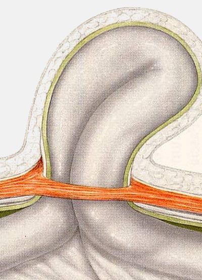 Increasing Number of Hernia Operations per Year Creating Opportunity for MedTech Manufacturers
