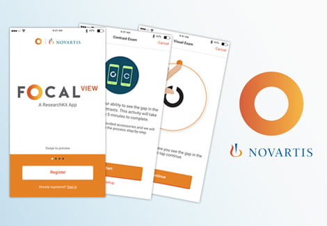Novartis Launches FocalView App, Providing Opportunity for Patients to Participate in Ophthalmology Clinical Trials from Home