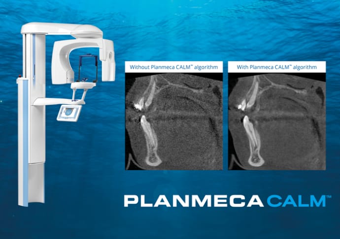 Outstanding Imaging with Planmeca CBCT Units