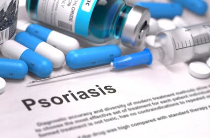 Psoriasis Treatments to Become Cheaper as Biosimilars Compete in $5 Billion U.S. Psoriasis Drugs Market – New Study by iData Research