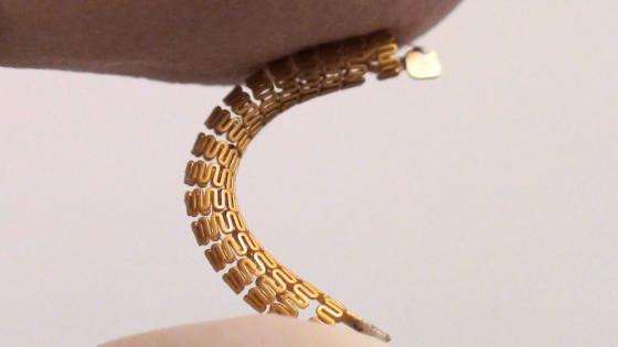 ‘Smart Stent’ Detects Narrowing of Arteries