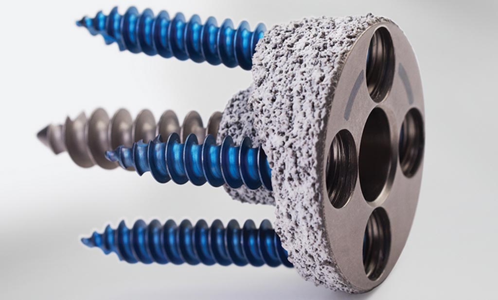 Zimmer Biomet Announces FDA Clearance of the Comprehensive® Augmented Baseplate for Shoulder Reconstruction