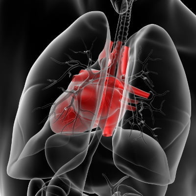 New Study Shows Approximately 340,000 CABG Procedures per Year in the United States