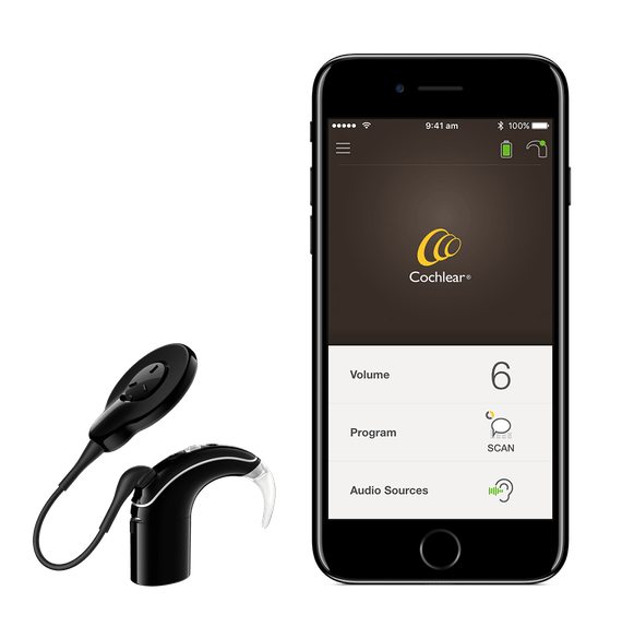 Cochlear Brings Leading Hearing Technology to Android Smartphone Users