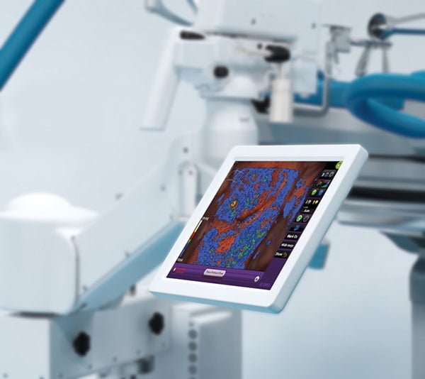 Dysis Medical Raises $25M