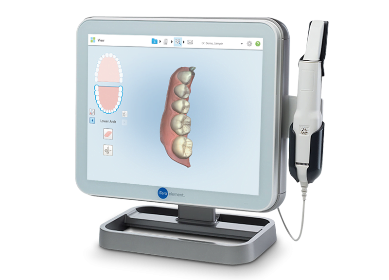 Align Announces New iTero Updates and Connectivity to Improve Customer Experience and Workflow for Dental Practices