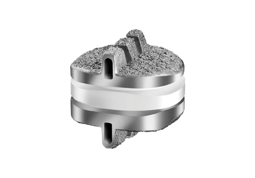 Globus Medical Celebrates Reimbursement Coverage for Secure-C Spinal Implant