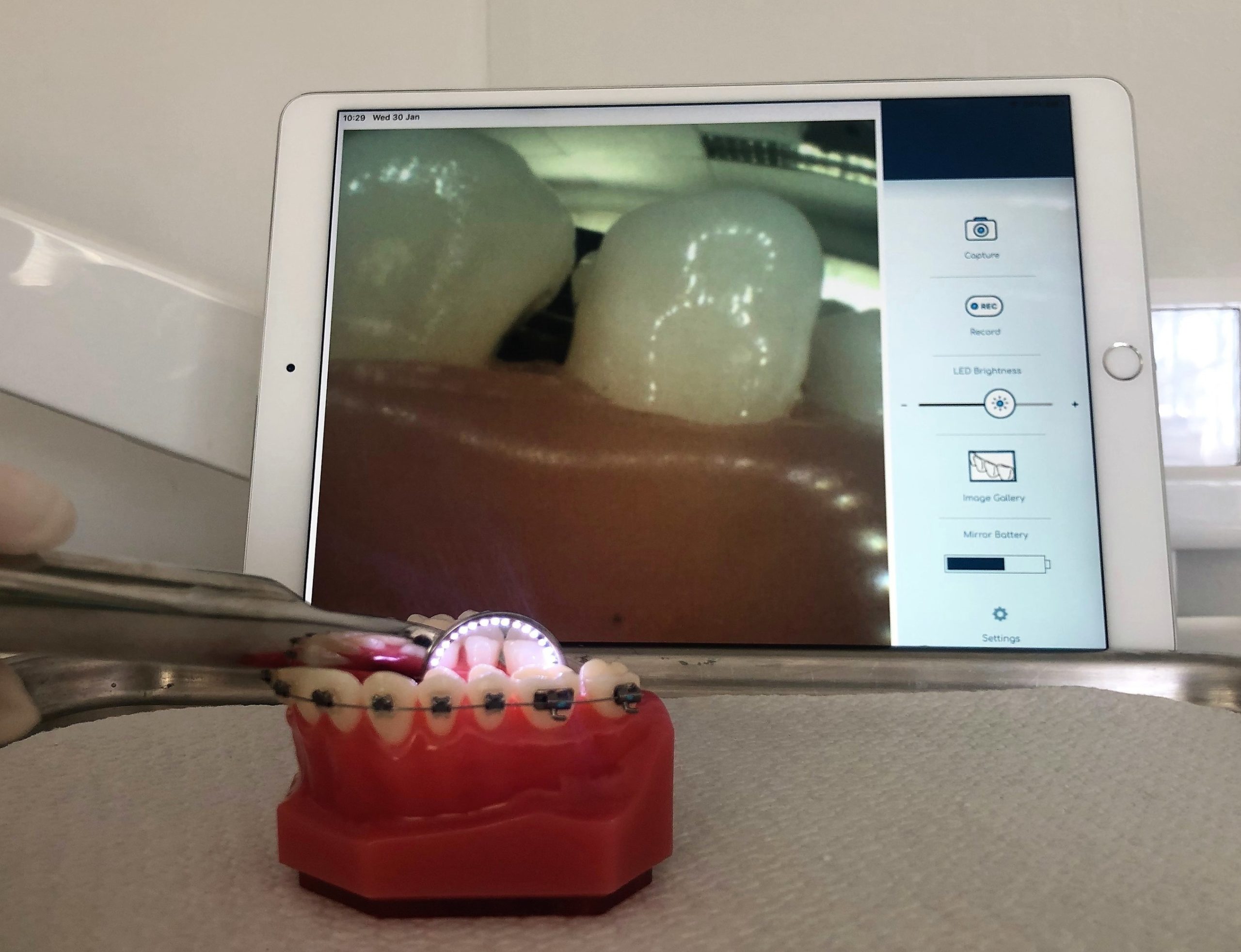 OmniVision Develops Breakthrough Smart Dental Mirror