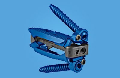 SpineEX Obtains Additional FDA Clearance for Sagittae LLIF System