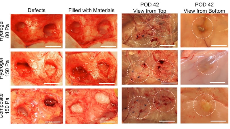 Johns Hopkins Researchers Develop Soft Tissue Substitute With Fewer Side Effects