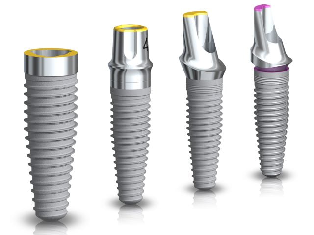 Nobel Biocare Announces Next-Gen Implant System in Madrid