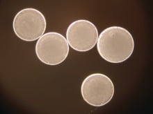 IMBiotechnologies Ekobi Microspheres Expanded