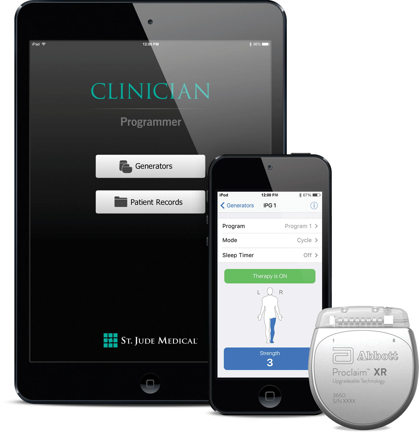 Abbott’s Low Dose Neuromodulation Implant for Chronic Pain