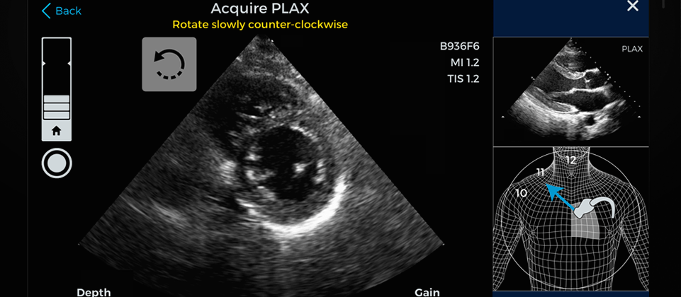 FDA Approves AI Software to Capture Heart Images Via Ultrasound