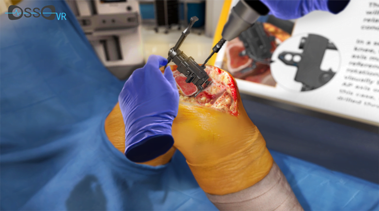 Osso VR Partnering with MicroPort Orthopedics to Provide VR Training Module for Hip and Knee System