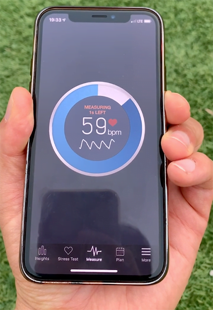 New Diabetes Test Using Smartphone and Deep Learning