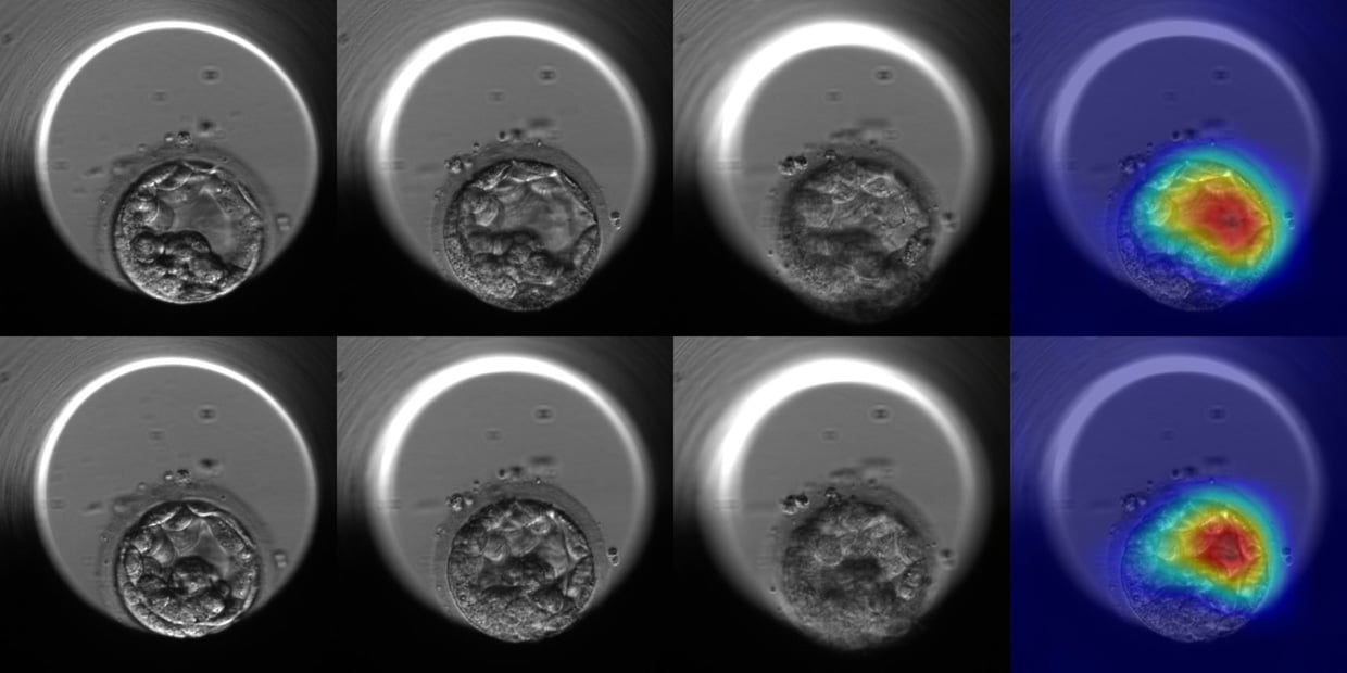 Can AI Help Improve In-Vitro Fertilization Rates?