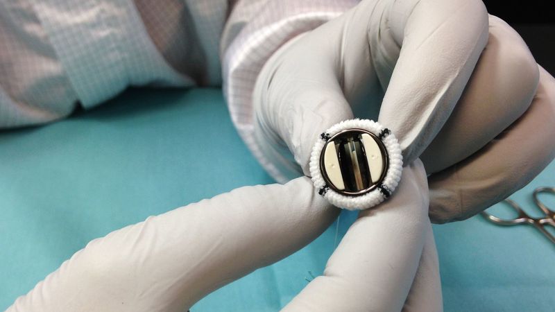 U.S. Mechanical Heart Valves: Abbott's 15-millimeter mechanical heart valve used in pediatrics