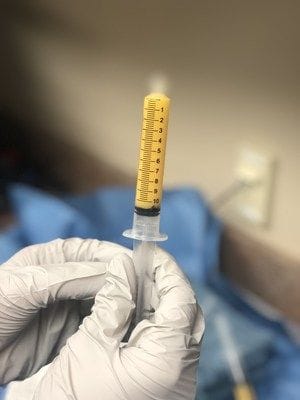 Lipogems' Receives FDA Clearance For Microfragmented Adipose Tissue System