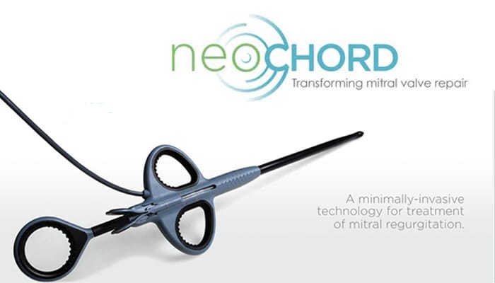 NeoChord Announces $25 Million Series D Financing to Accelerate Development of Two Transcatheter Chordal Repair Programs
