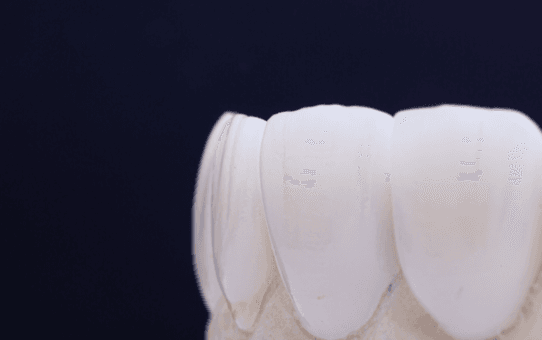 How Off-Label Sales are Challenging the Dental Biomaterials Market in Latin America