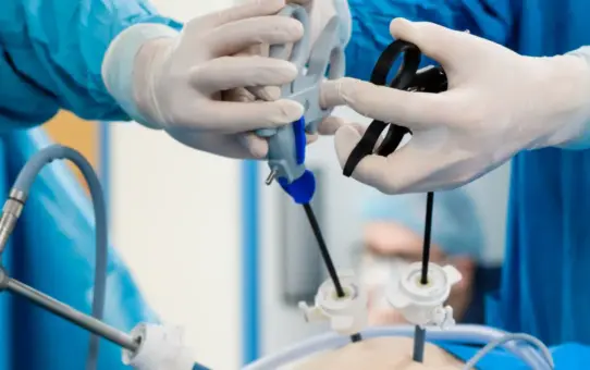 The Evolution of Laparoscopic Surgery: Trends and Innovations in the European Market