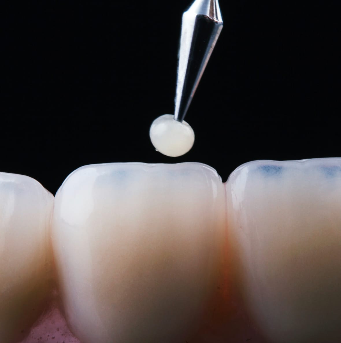 Global dental materials