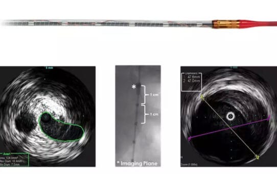 Top Brands per Segment in the US FFR, IVUS, and OCT Consoles, Catheters, and Guidewires Market