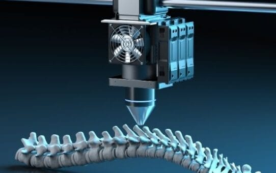 Spinal Implants Are Evolving: What’s Next in 2025?