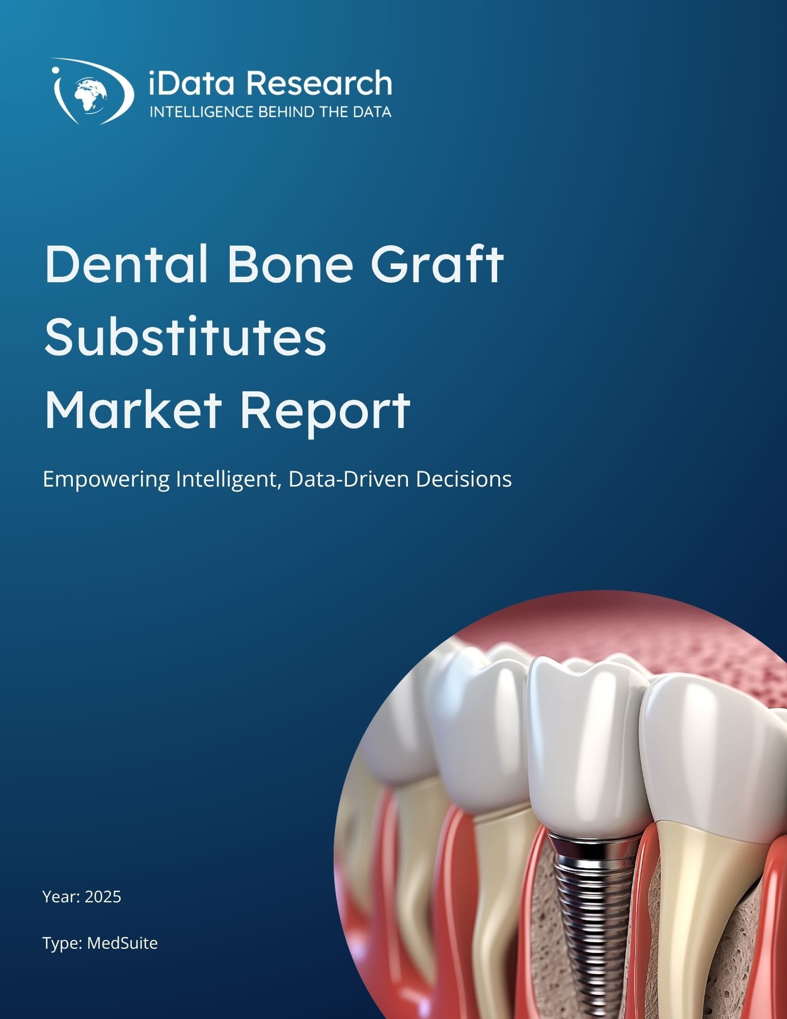 Dental Bone Graft Substitutes Market