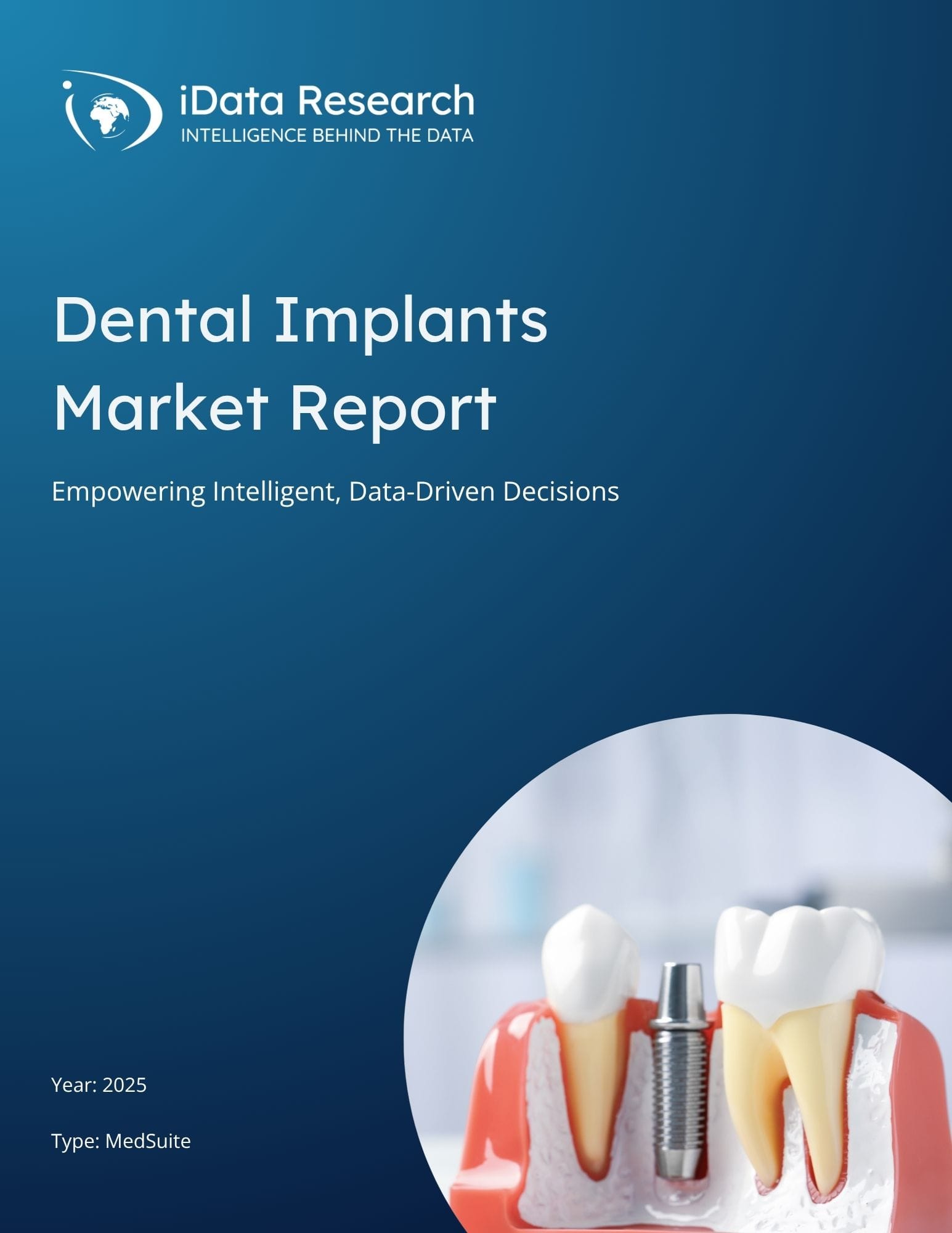 Dental Implants Market