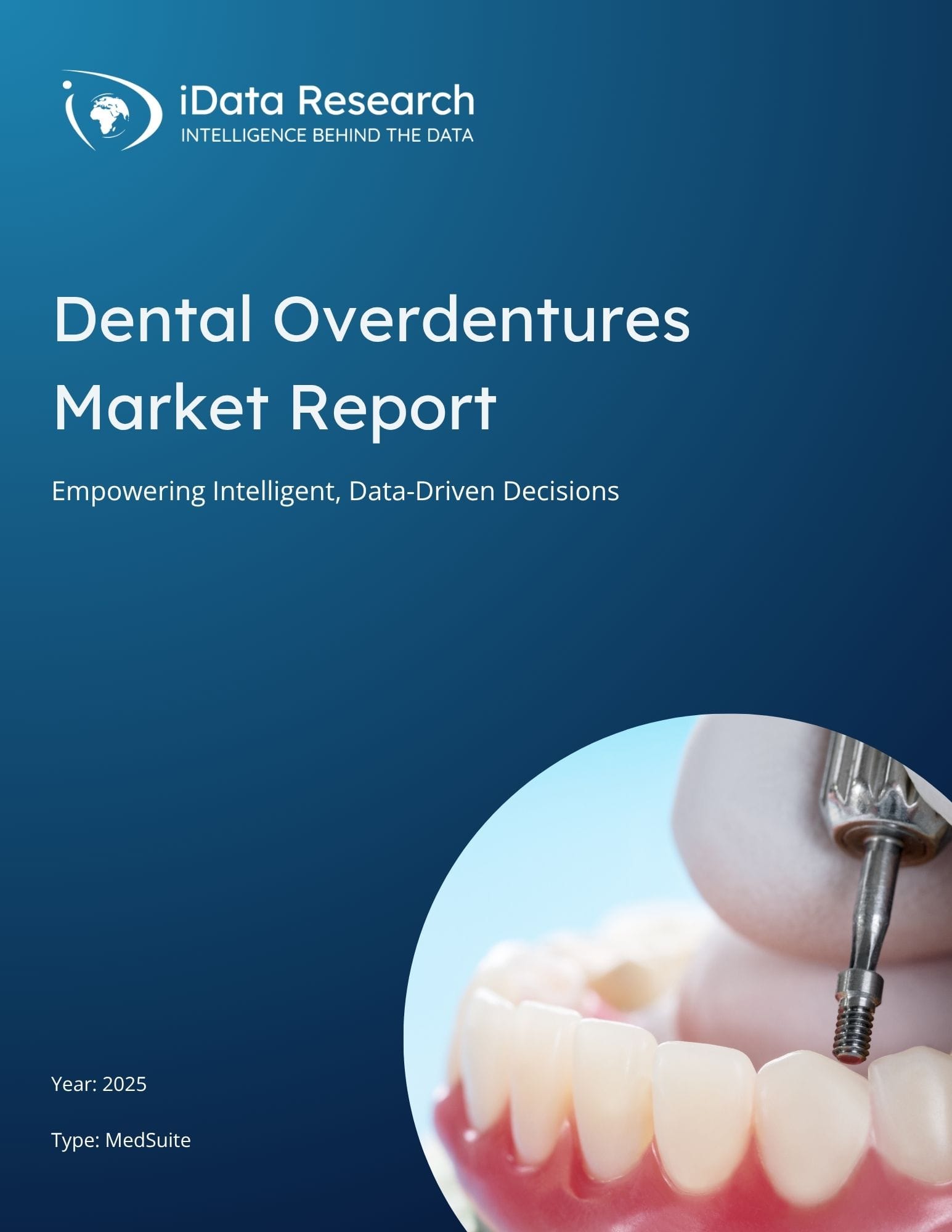 Dental Overdentures Market