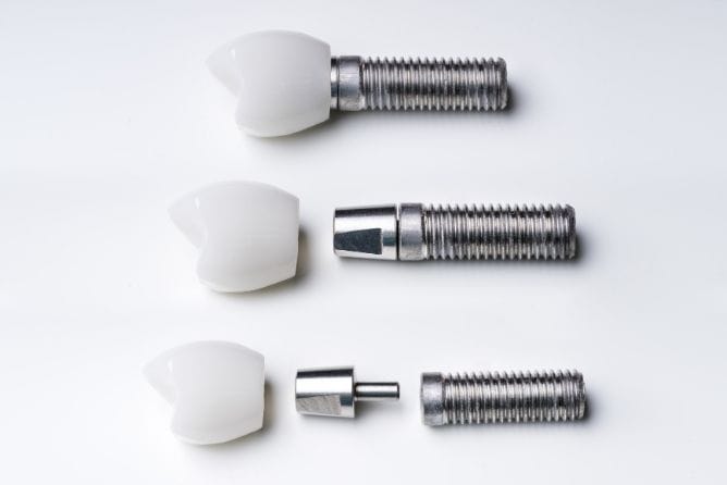 How Volume-Based Procurement Is Changing Dental Implants in China