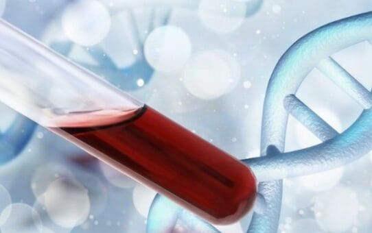 Top 5 Market Trends in In Vitro Diagnostics (2026)